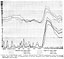 Chart 15