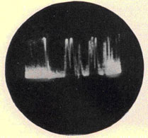 Window Echoes on Different Radars