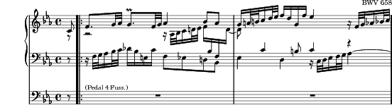 Music preview