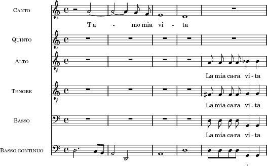Music preview