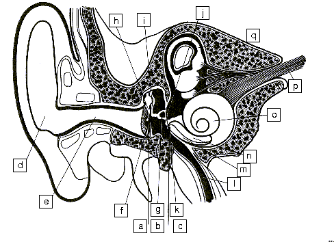 Cochlear Implant Diagram