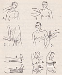 Illustration of first aid techniques