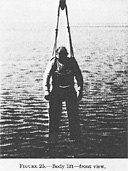 Figure 25.--Body lift--front view.