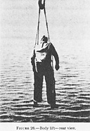 Figure 26.--Body lift--rear view.